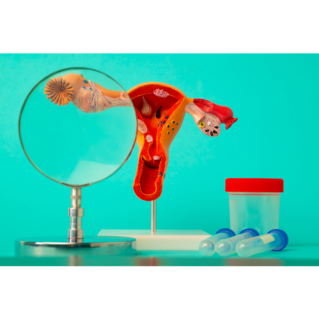 Best Gynaecologist in Faridabaad for PCOD holistic treatment